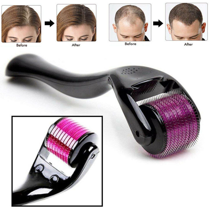 Titanium microneedle roller for hair stimulation